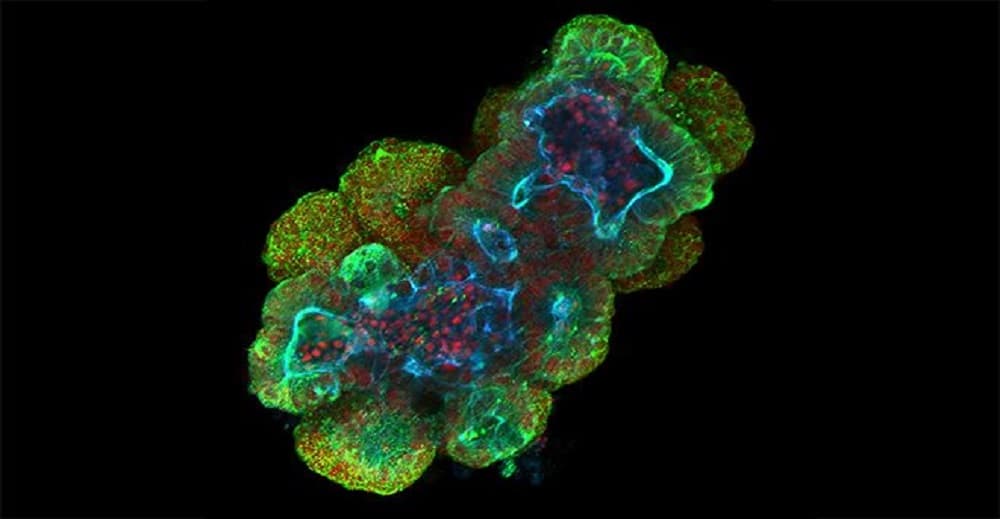 The Growth of Research & Development in the Healthcare Sector Gives Rise to the Global Organoid Technology Market