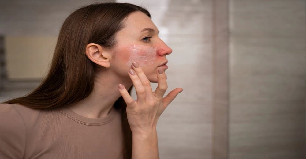Innovations in Ever-Evolving Landscape of the Acne Treatment Market