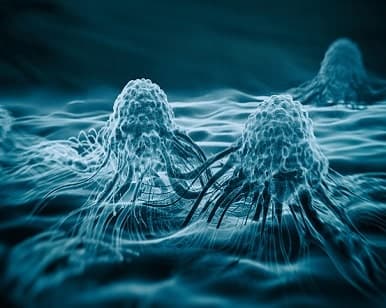 Pre-detection Reduces Fatal Risk of Cancer