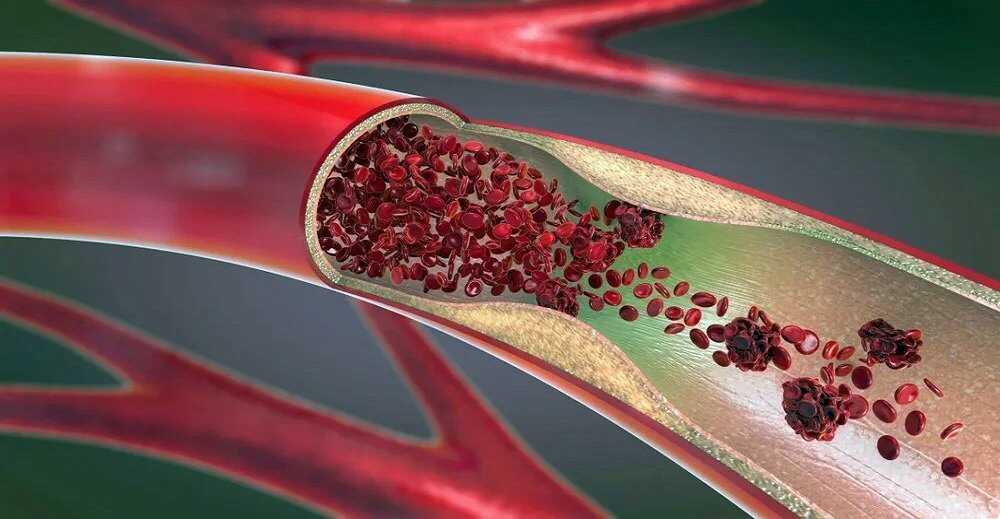 Ageing population has propelled the Vascular Graft Market Growth